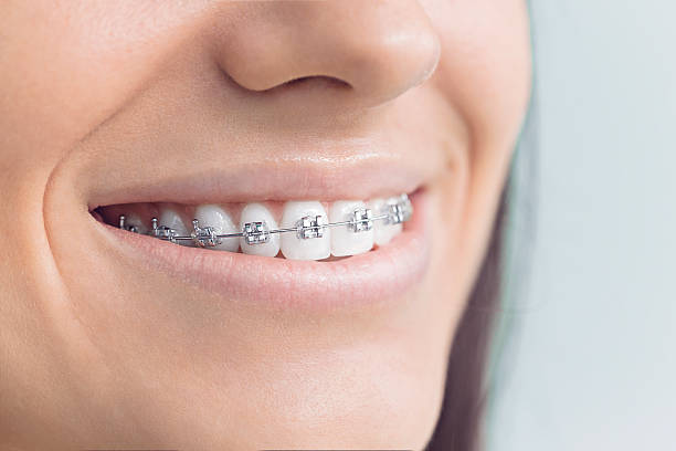 Best Traditional Braces  in Wolf Lake, MI